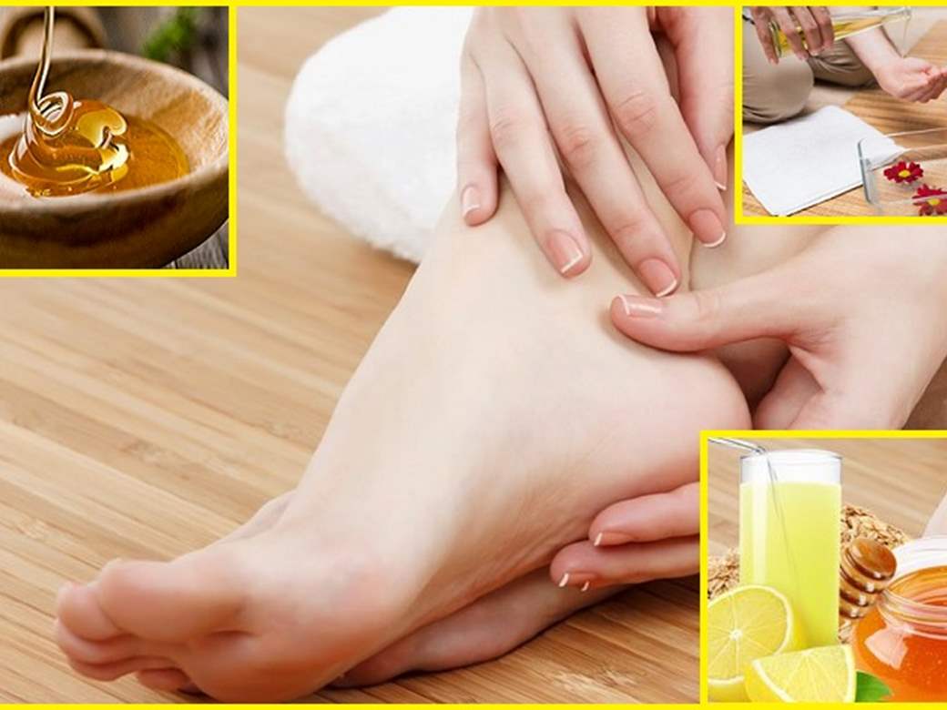 How to Heal Cracked Heels Overnight at Home