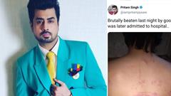 RJ Pritam Singh Gets Hurt While Rescuing a Couple From Being Brutally Beaten up!