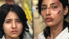 'Mirzapur 3' brings with it the memories of the last season: Here's how Harshita shot with injuries Thumbnail