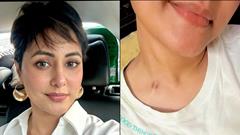 Hina Khan proudly shows off her scar while undergoing cancer treatment, says, 