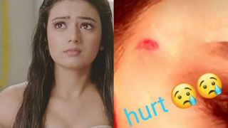 Neha Solanki gets INJURED on set!