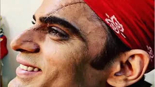 Mohit Malik is ‘SCARRED AND HAPPY’ and we know WHY! Thumbnail