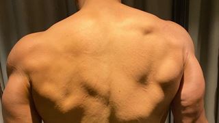 Tiger Shroff's Bruised Back is a result of Baaghi 3!