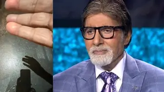 Amitabh Bachchan on his Hand Injury: A Diwali bomb exploded in my hand and blew it up... Thumbnail