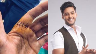 Shagun Pandey of 'Meet' gets six stitches on this hand; showcases extreme dedication to work 