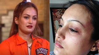 Lock Upp: Post revelation about abuse after miscarriage, Nisha Rawal’s pictures with bruises go viral 