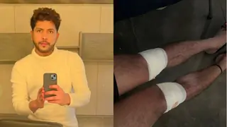 Nishant Bhat suffers major injuries while performing 'Khatron Ke Khiladi 12' stunts Thumbnail