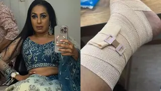 Laughter Chef Unlimited: Kashmera Shah injured after falling on set Thumbnail