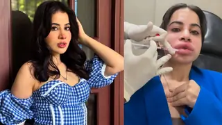 Uorfi Javed flaunts natural face after dissolving lip fillers: "all the trolling, memes, I honestly had a..." Thumbnail
