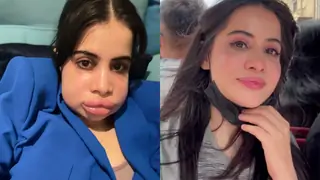 Uorfi Javed gives glimpse of healing from her lip filler journey, says, 'Some said its upar wale ka aazab'
