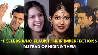11 Celebs Who Flaunt Their Imperfections Instead of Hiding Them