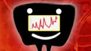 What do our producers expect from the revised TAM sheets? Thumbnail
