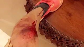 Look which TV actor met with an accident! Thumbnail