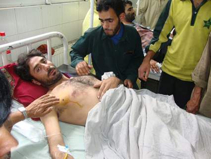 A person injured in the grenade attack in Srinagar Monday under treatment in hospital