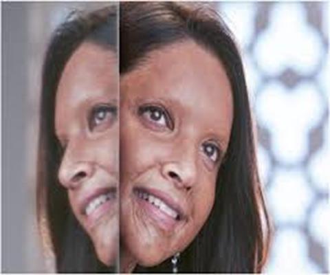 Malti from Chhapaak