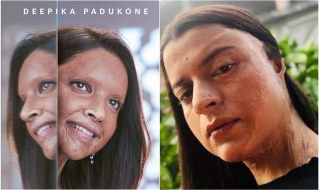 chhapaak deepika kangana rangoli 