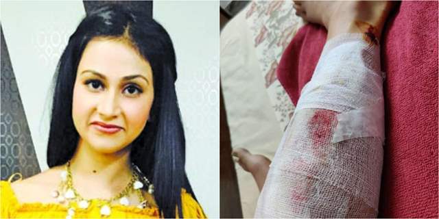 Aanchal Khurana met with an accident 