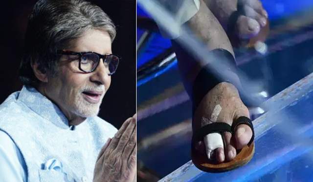 Amitabh Bachchan toe fractured