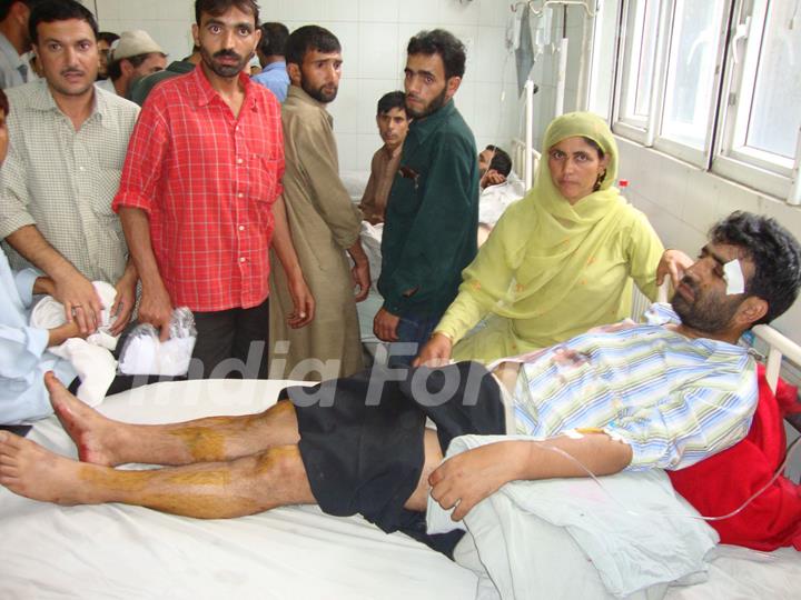A person injured in the grenade attack in Srinagar Monday under treatment in hospital