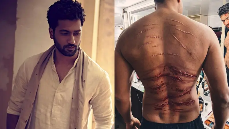 Vicky Kaushal and his bruised look from Sardar Udham